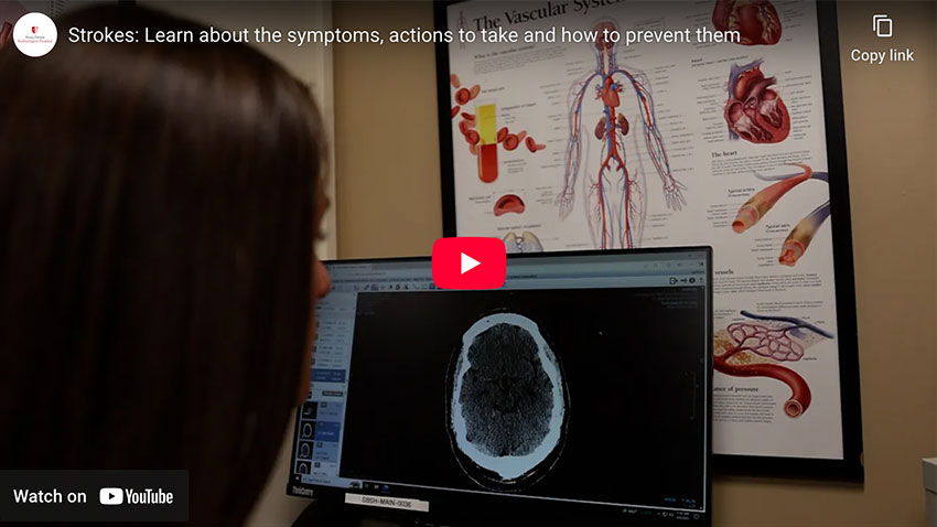 Woman looking at screen with image of mri of the brain